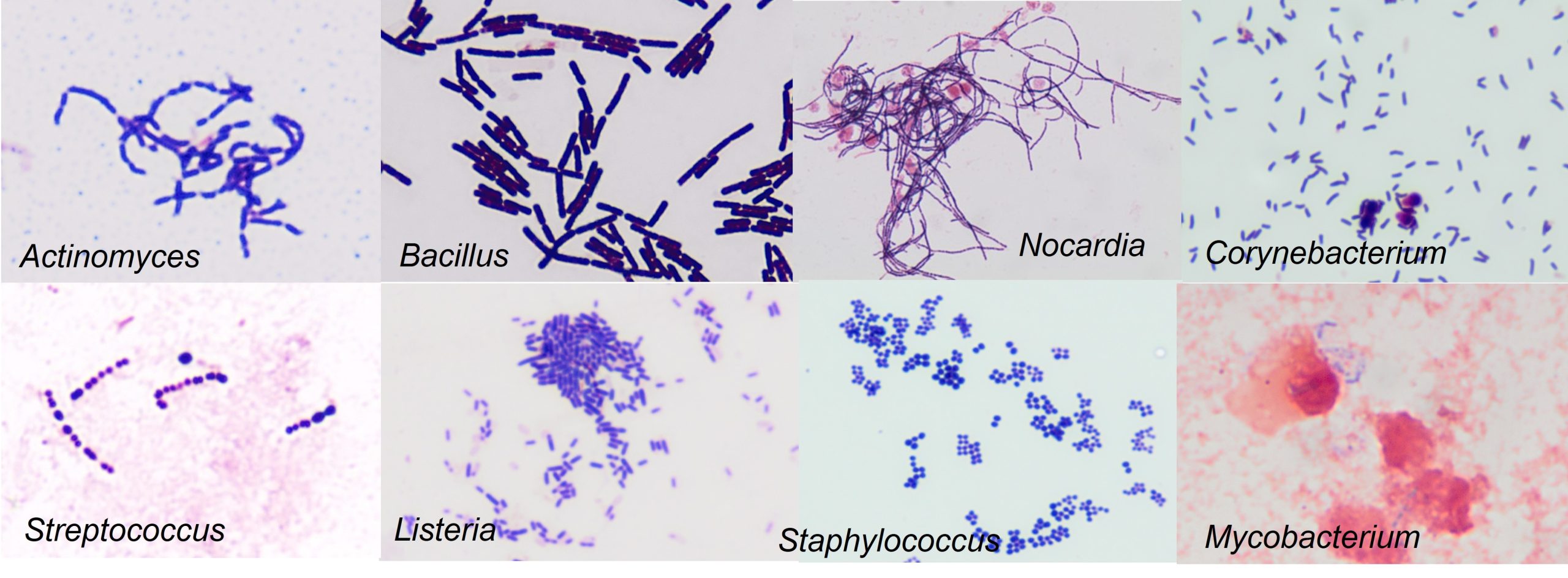 Gram positive bacteria compilation