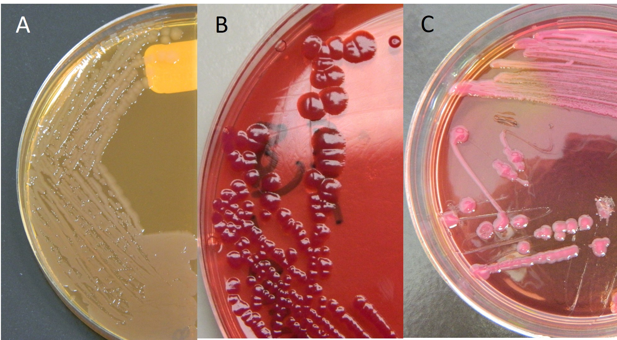 MacConkey agar a selective and differential medium: A: Salmonella produces pale, non-lactose fermenting colonies; B: Escherichia coli produces pink to purple lactose fermenting colonies; C: Klebsiella produces pink, mucoid colonies