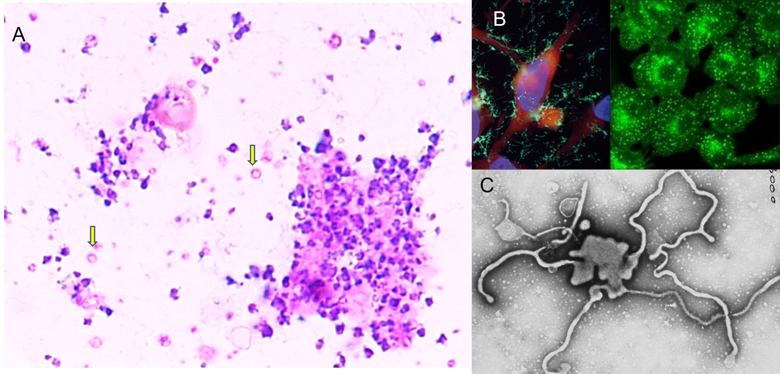 Staining of mycoplasmas. A: Modified Wrights stain of mycoplasmas isolated from the joint of a goat. Wrights stains will usually stain all bacteria purple. Note the ring like structures that some mycoplasmas will form. B: Flourescent stains of mycoplasmas. Note that some have long filaments and others are coccoid. C: A transmission electron microphotograph of Mycoplasma felis. Note that it can take on any shape. A real shape-shifter.