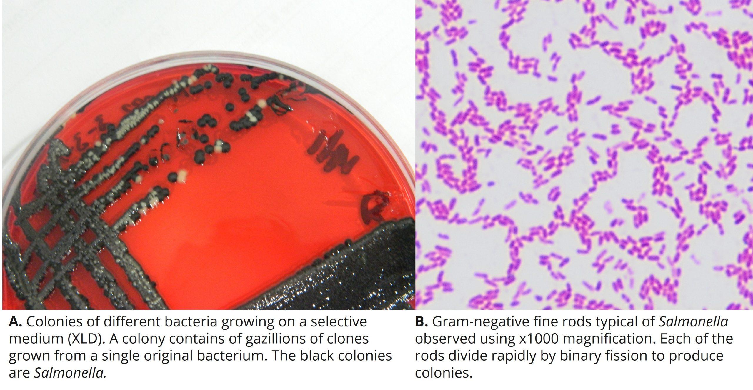 Salmonella being grown on agar and a Gram's stain of a black colony