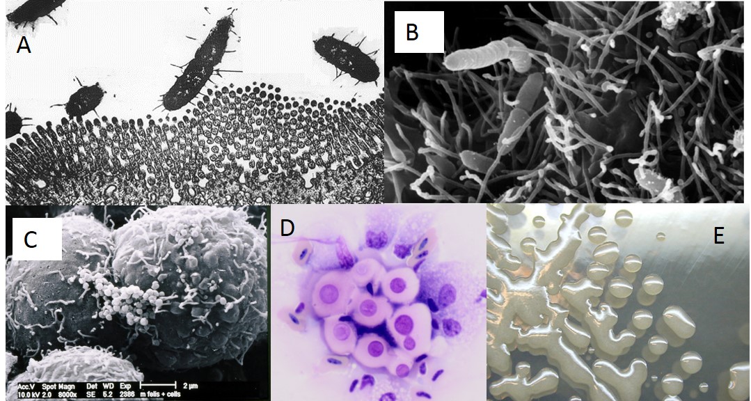 Bacterial adhesion structures. A: pili; B: Flagellae; C: outer membrane proteins; D: capsules; E: slime