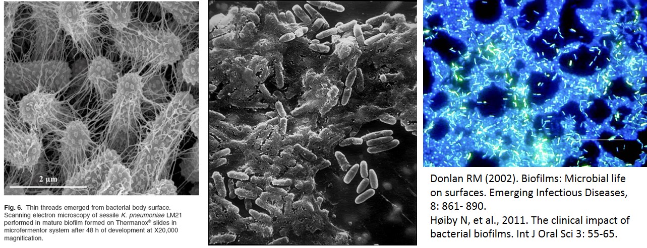 Biofilm examples. Picture on the left is a SEM of a biofilm with EPS threads joining the Gram negative coliform Klebsiella pneumoniae, The middle is a SEM of Escherichia coli in EPS and showing the EPS channels using flourescent microscopy in the picture on the right.