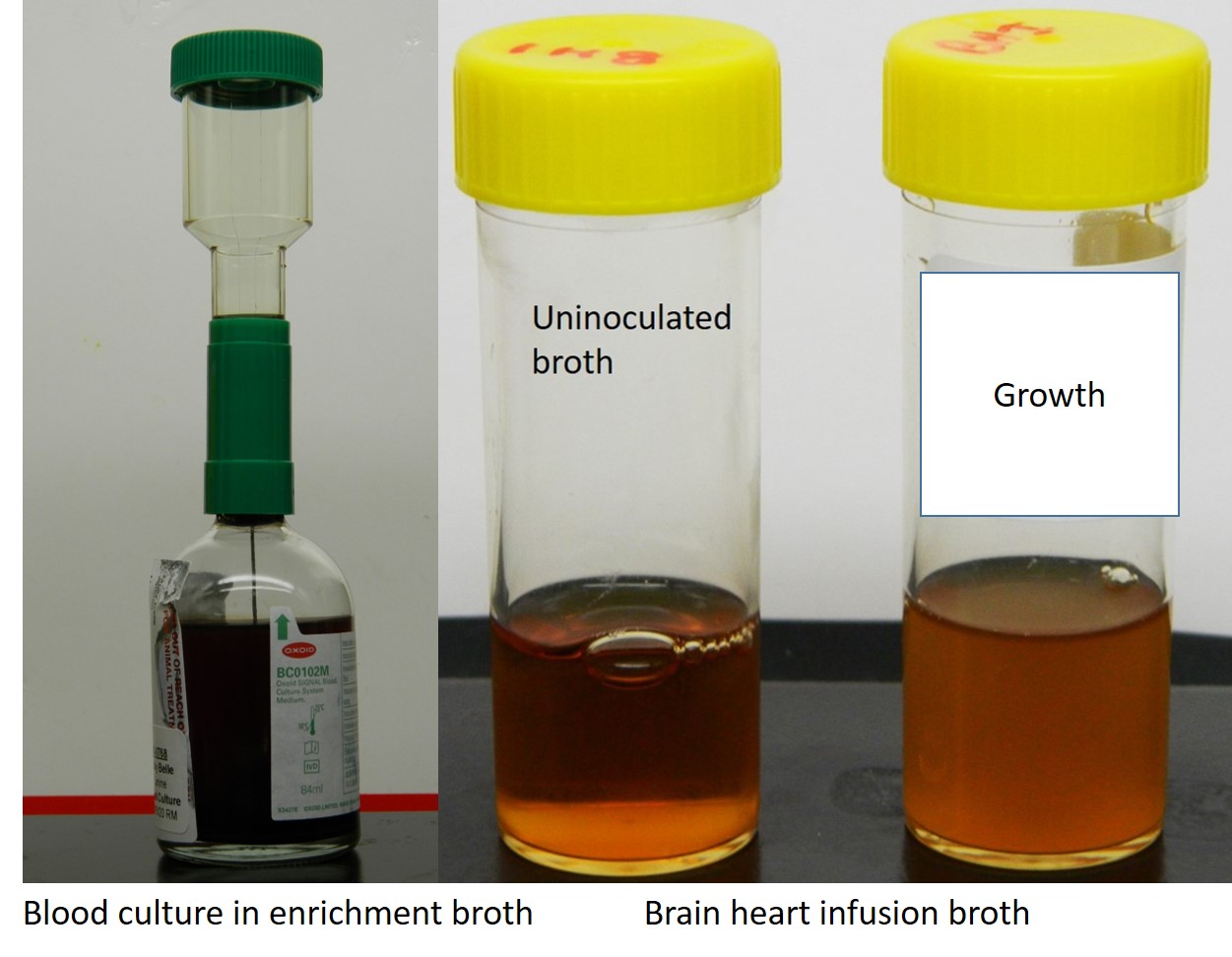 Examples of enrichment media. On the left a blood culture bottle that ahs a very rich mixture of proteins, fats, minerals and buffers in it. On the right is brain heart infusion broth. The picture on the far right shows growth in the broth