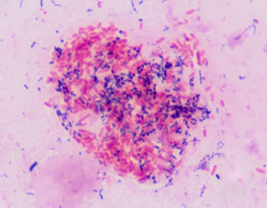 Gram's stain of the faeces of a wallaby. There are pink Gram negative rods and purple Gram positive cocci.