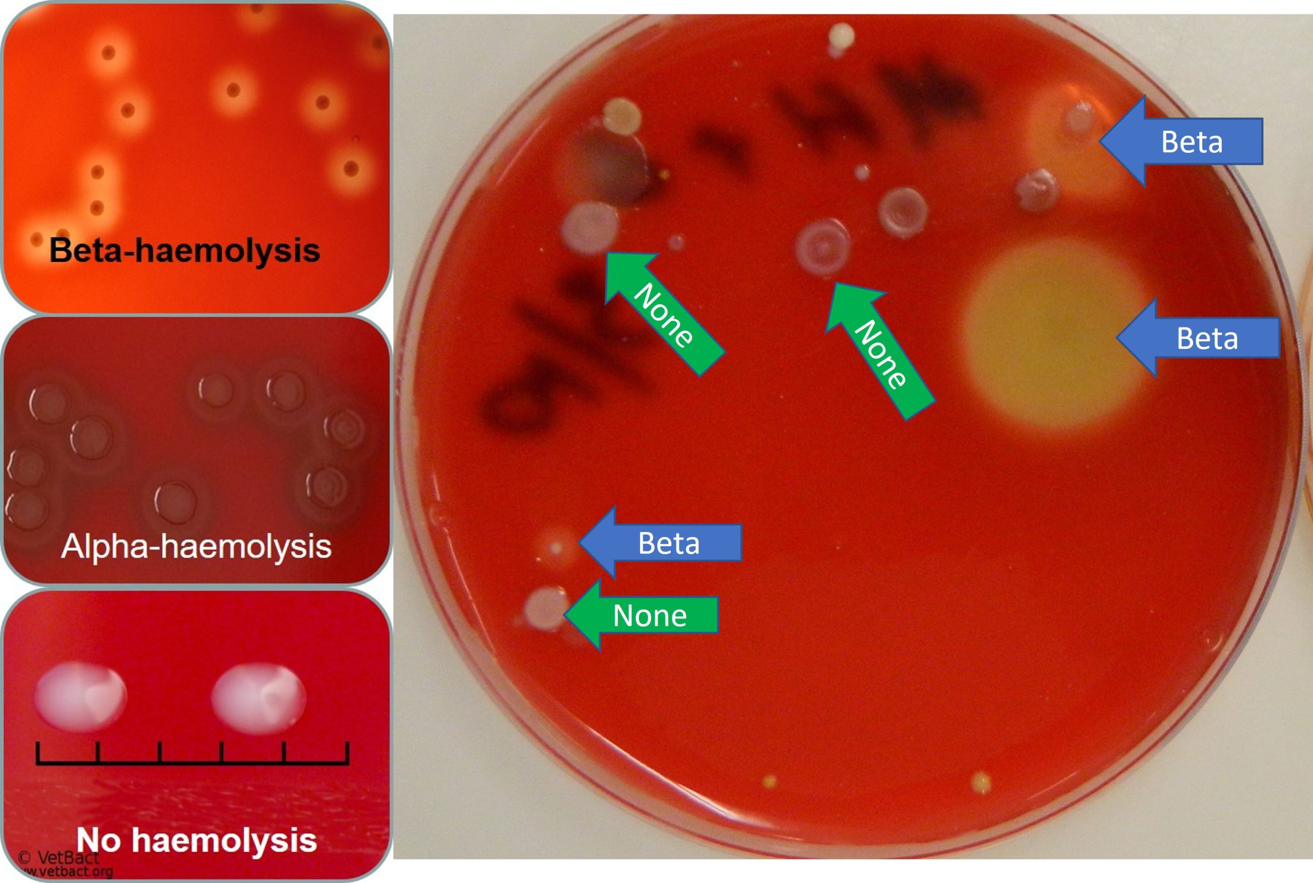 Haemolysis of blood agar caused by different bacterial species colonies. The green arrows indicated non haemolysis and the blue arrows beta-haemolysis. A example of alpha-haemolysis is shown in the middle picture on the left.