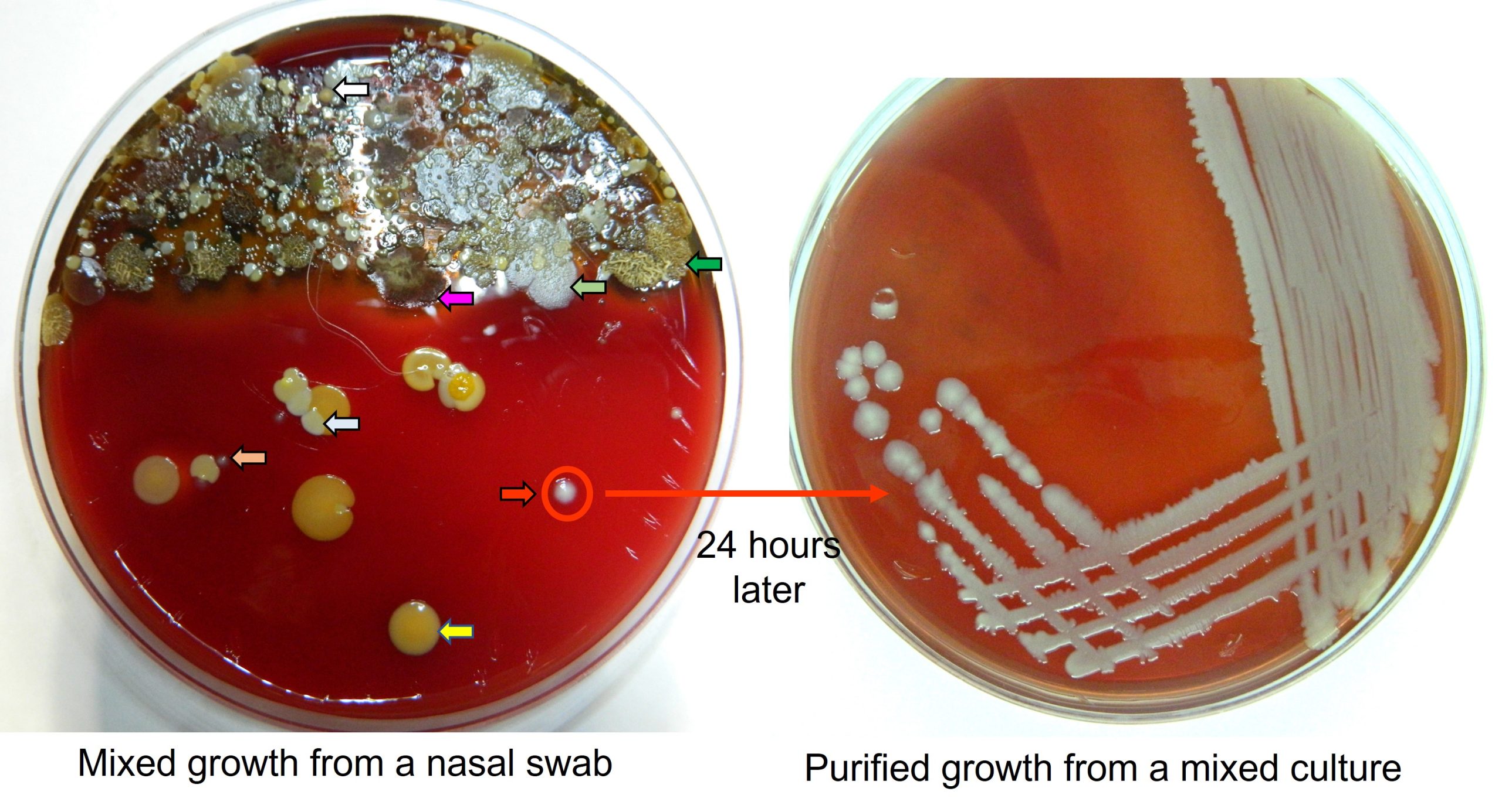 A mixed growth from a swab taken from a horse's nasal passage. Each different coloured arrow indicates a different colony type and thus bacterial species. Not all the different colony types on this agar have an arrow. The picture on the right shows a purified growth using the colony indicated by the red arrow. Identification and antimicrobial therapy can now proceed.