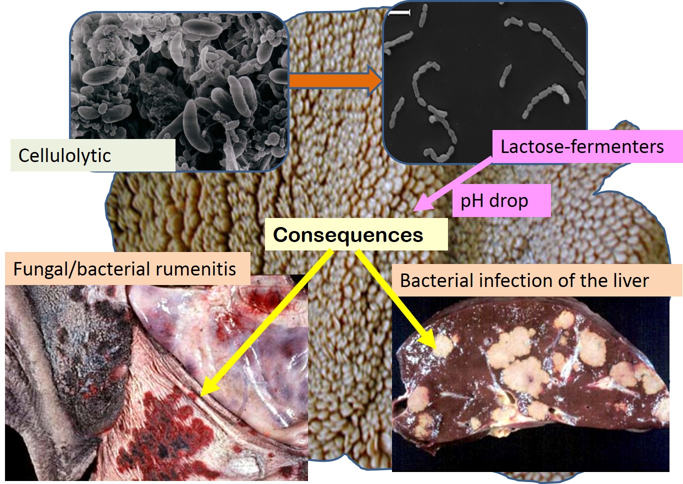 Picture showing the pathological consequences of rumen acidosis which leads to a change in the normal microflora. Acid-resistant pathogenic bacteria and fungi cause rumenitis. They are able to invade into the blood vessels and lodge in the liver causing multi-focal areas of necrosis. They are even transported to the lungs where they rupture blood vessels and cause abscessation.