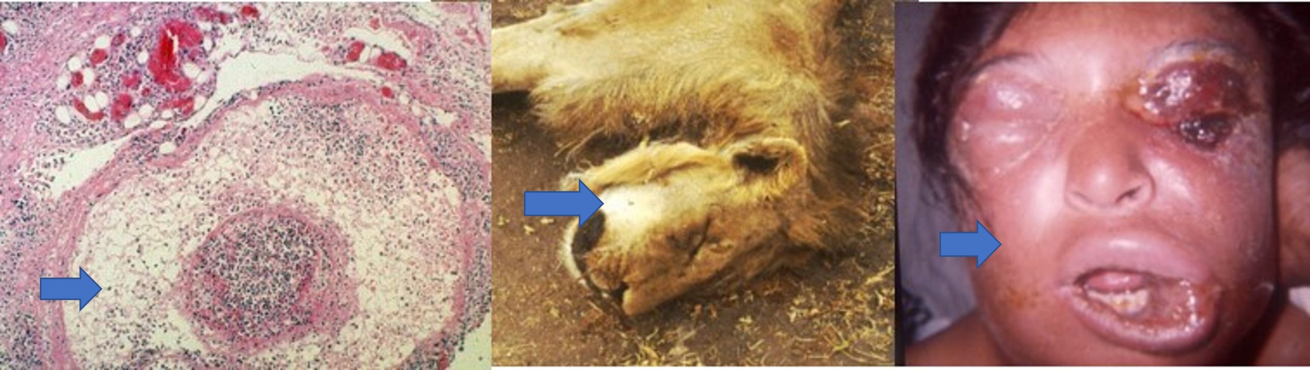 The effect of oedema toxin on tissues