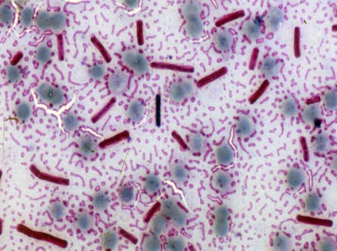 Bacillus anthracis in a bloodsmear from an animals that has died from anthrax