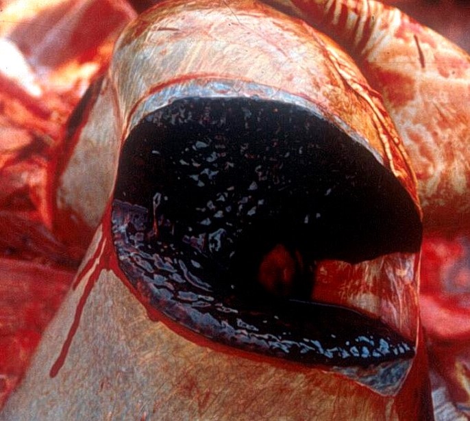 Enlarged spleen caused by Bacillus anthracis