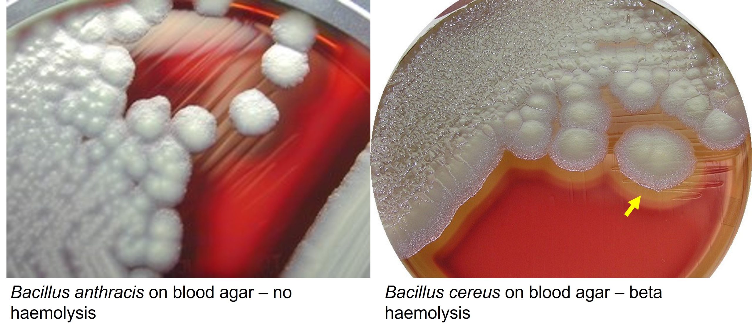 Comparison of colonies of B. anthracis and B. cereus growing on blood agar