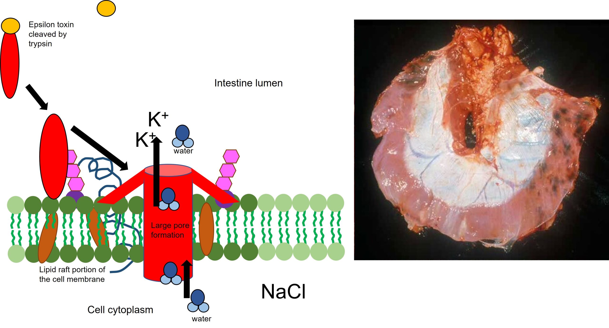 Formation of large pores by the active portion of Epsilon toxin. The large pore size allows the loss of potassium and fluids and disrupts the cell membrane leading to cellular destruction. The pictures on the right shows haemorrhage in the diaphram of a lamb that has died from pulpy kidney caused by the Epsilon toxin of Clostridium perfringens type D