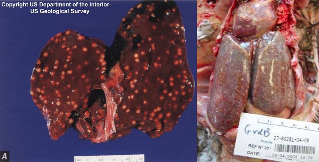 Avian tuberculosis. Initial infection of the gastrointestinal tract has led to lymphogenous and haematogenous (lymphohaematogenous) spread to the liver and and spleen. Notice in Picture A the numerous pale coloured nodules in the liver. These are mycobacterial granulomas and because they are small and numerous, so-called miliary, it can be observed that it is likely that spread to the liver was lymphohaematogenous.