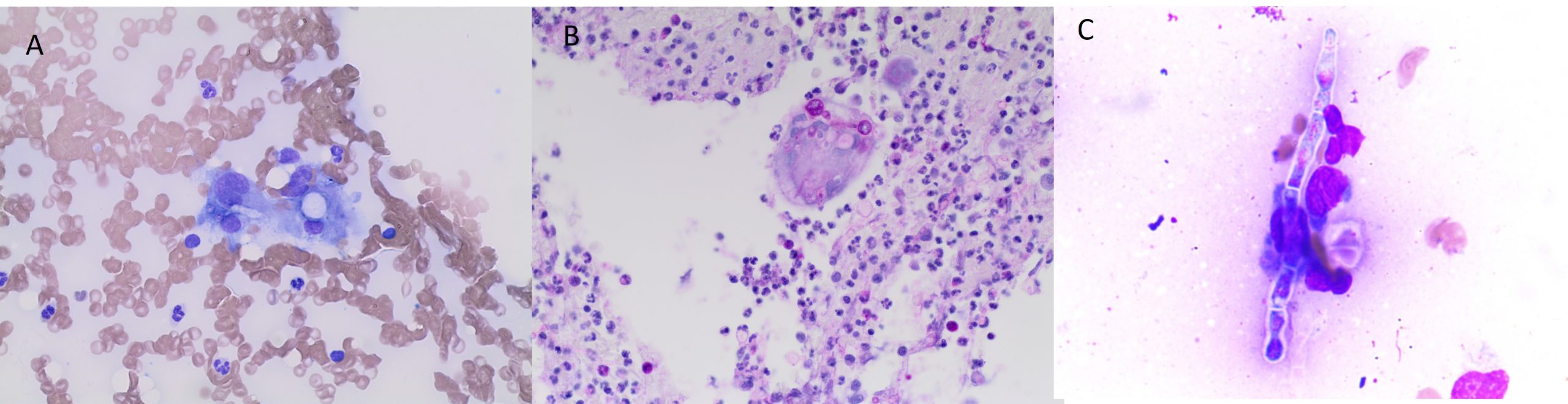 Cytology of fine needle aspirates of pyogranulomas from dogs suffering from systemic aspergillosis