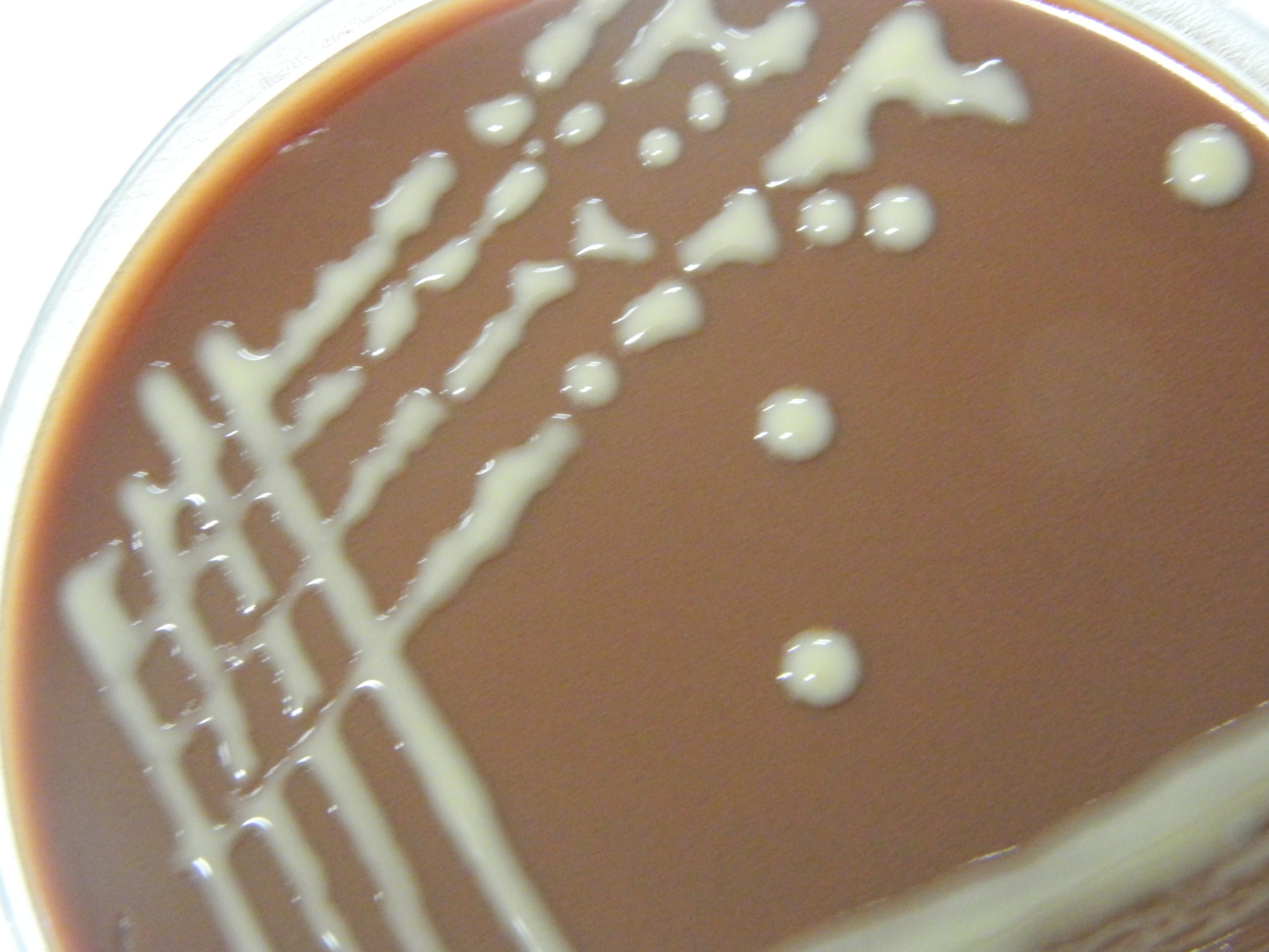 Mucoid colonies of Cryptococcus on chocolate blood agar