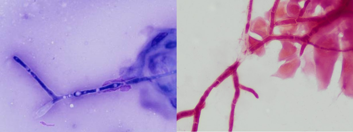 Cytology horse eye