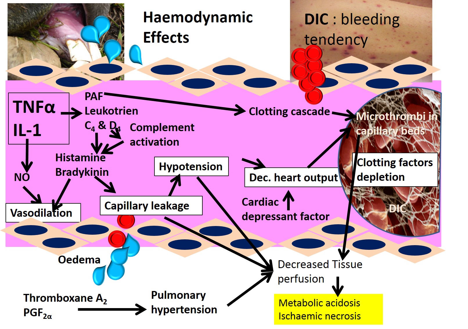 Schematic on the effect of endotoxin mediated inflammation on the blood circulation