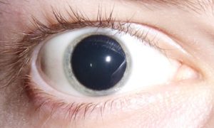 Image showing pupil dilation